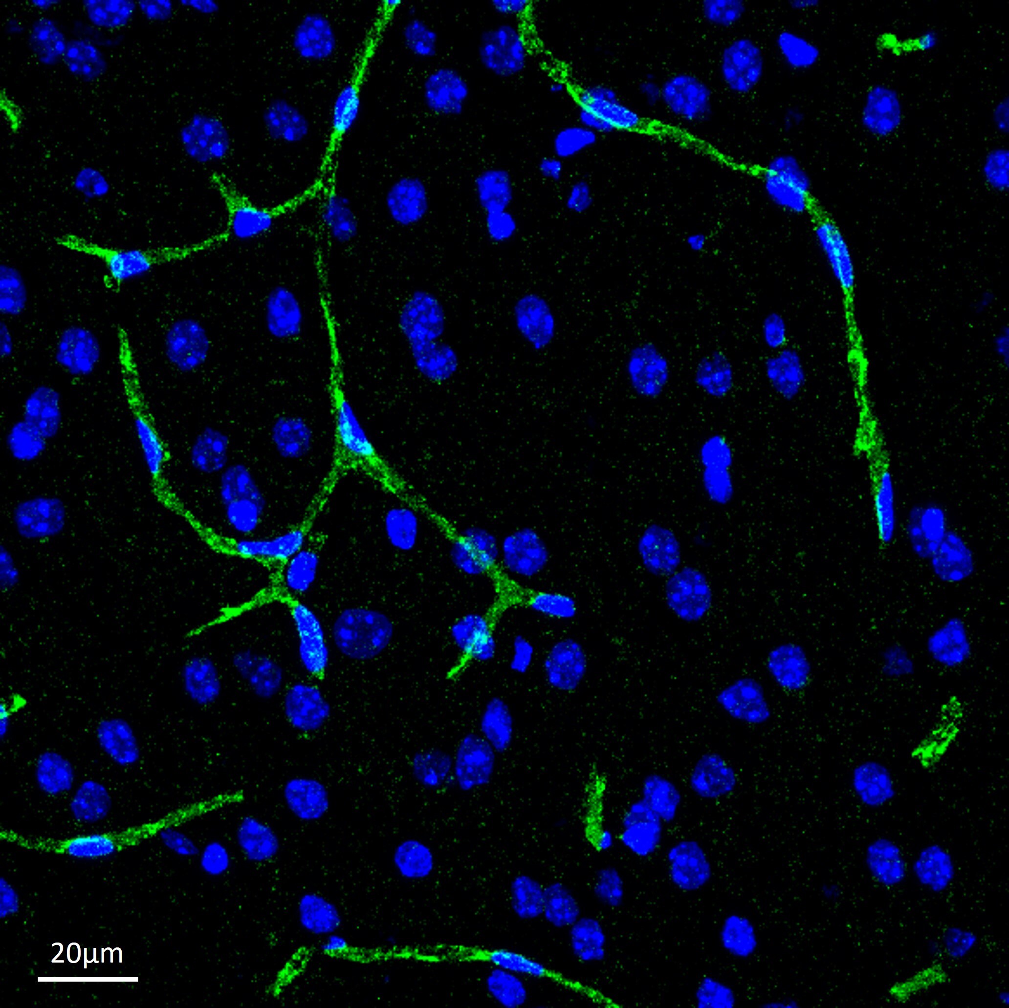 Donkey anti-Rabbit IgG (H+L) Secondary Antibody [DyLight 488] (Pre-adsorbed) NBP1-75292