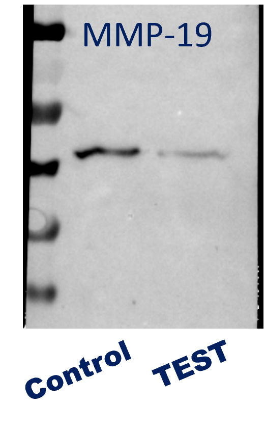 MMP-19 Antibody NBP2-17311
