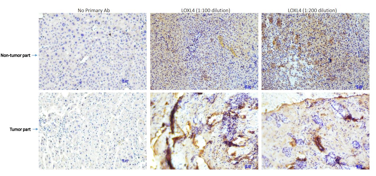 LOXL4 Antibody - Azide and BSA Free NBP3-04898