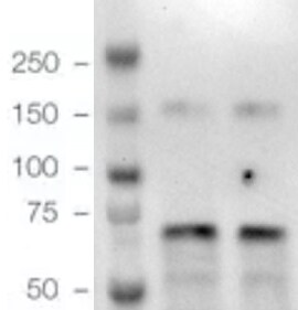 Glucosylceramidase/GBA Antibody (JM10-76) NBP2-66871