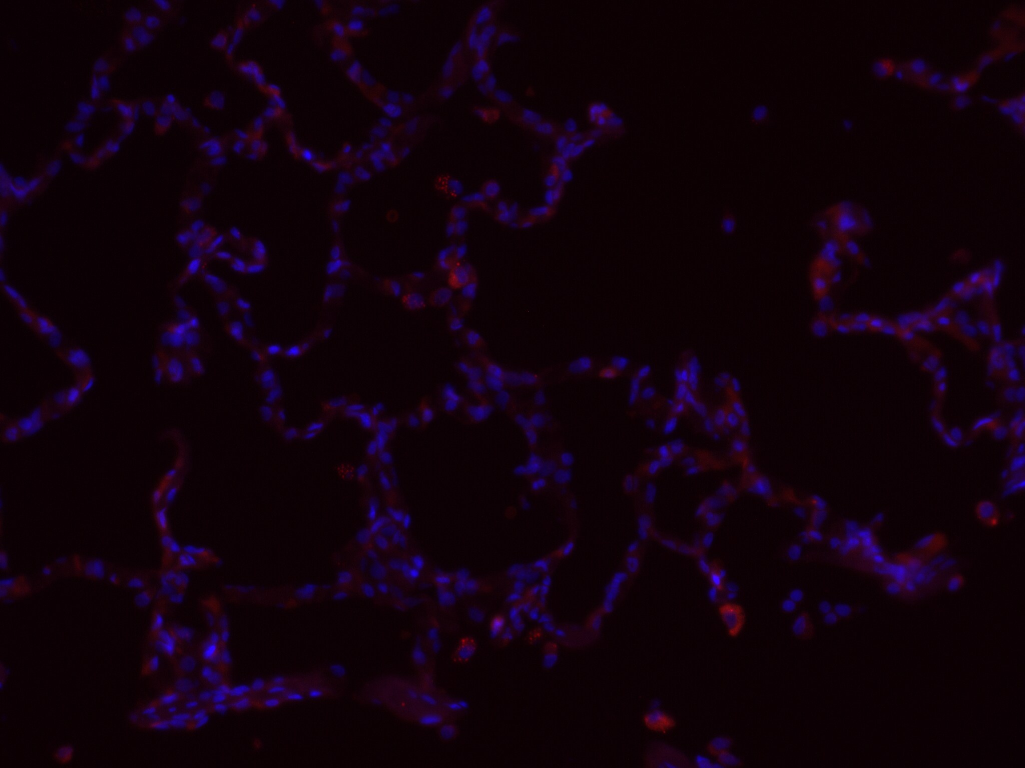 EpCAM/TROP1 Antibody (EGP40/1110) - (ECD) NBP2-44635
