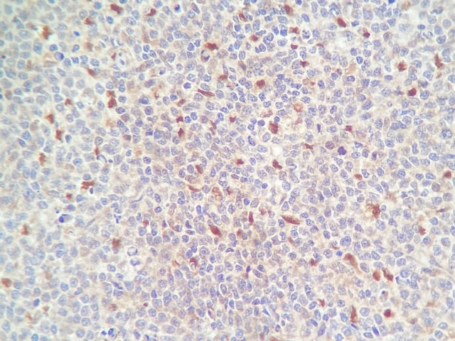 PD-L1 Antibody - BSA Free NBP1-76769