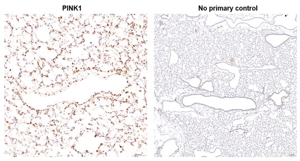 PINK1 Antibody - BSA Free BC100-494