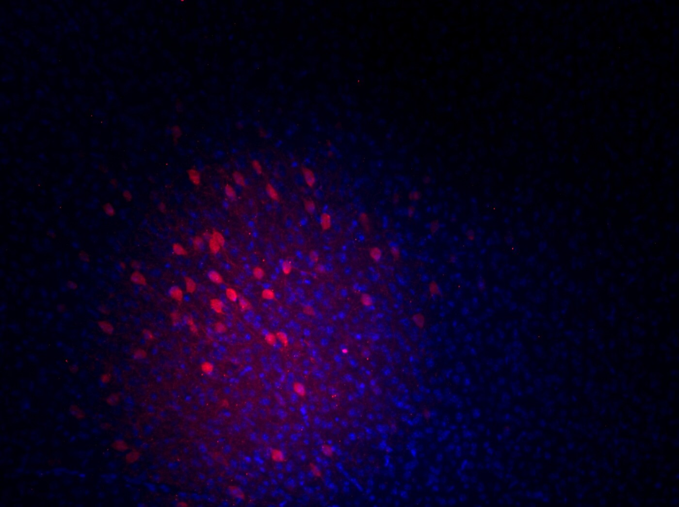 Human/Mouse/Rat Parvalbumin  alpha  Antibody AF5058