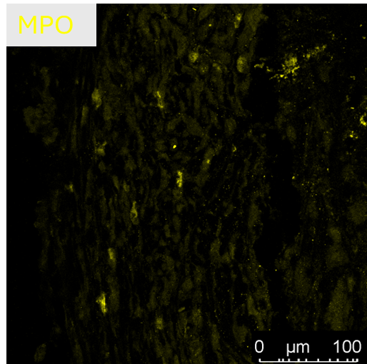 Myeloperoxidase/MPO Antibody AF3667