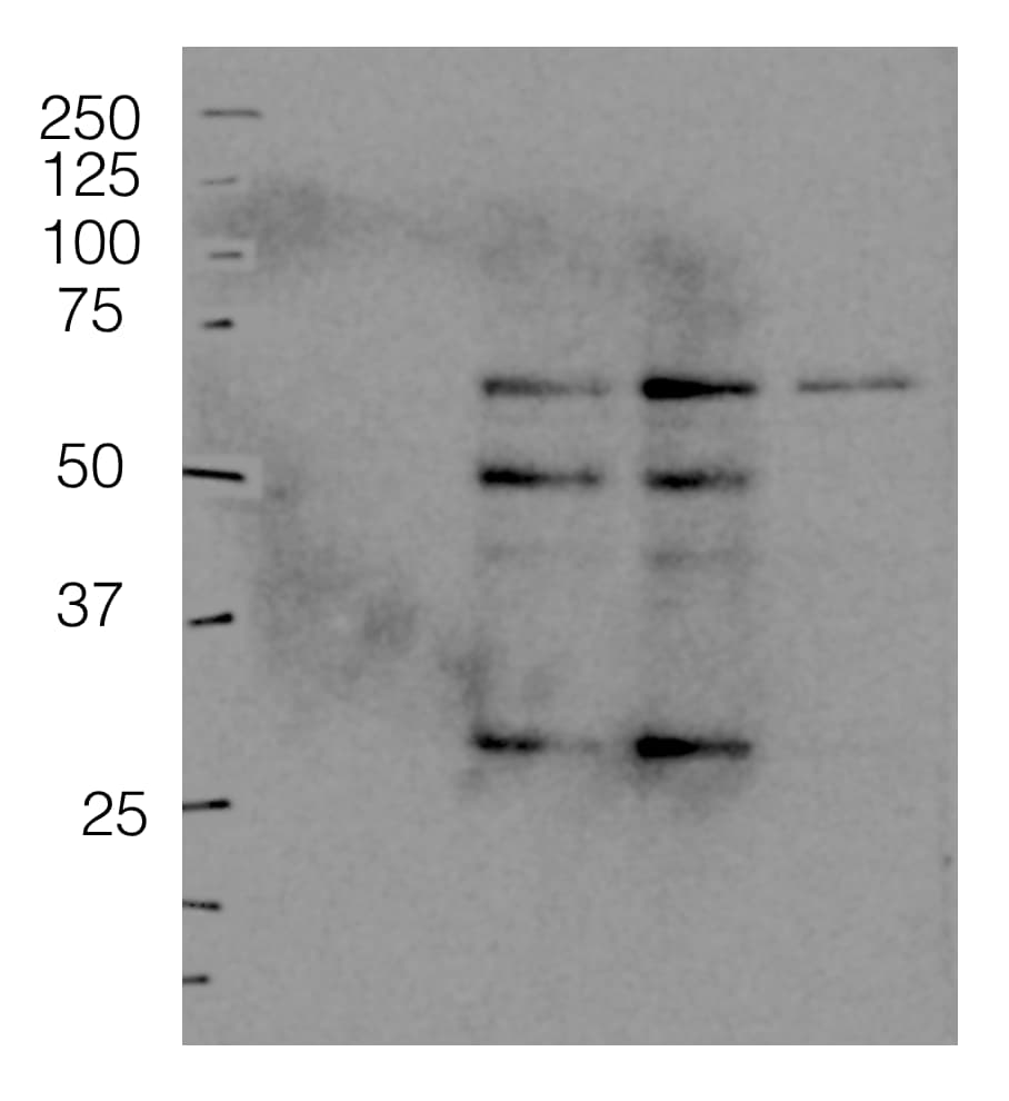 Plasminogen Antibody NB300-544