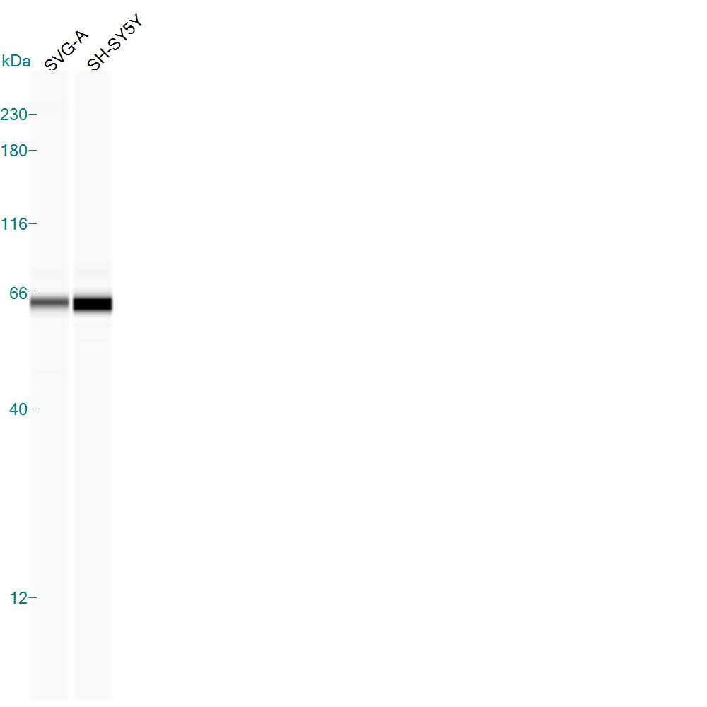 Human Transthyretin/Prealbumin Antibody MAB7505