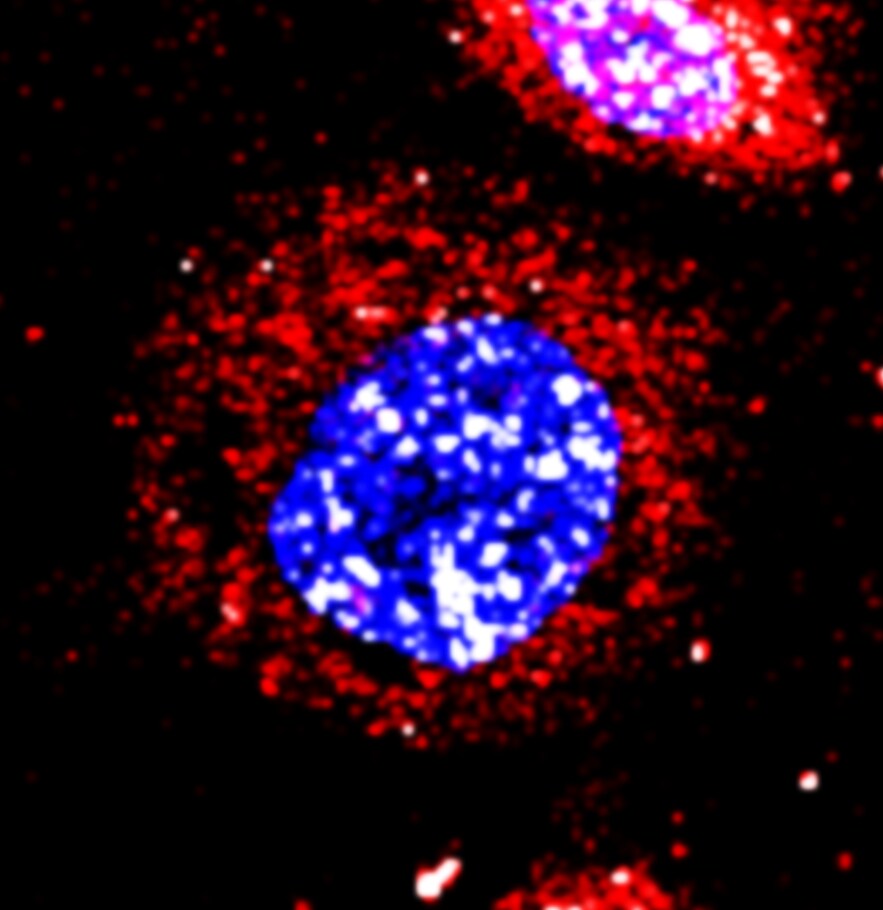 Human TACE/ADAM17 Ectodomain Antibody AF930