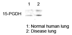 15-PGDH/HPGD Antibody - BSA Free NB200-179