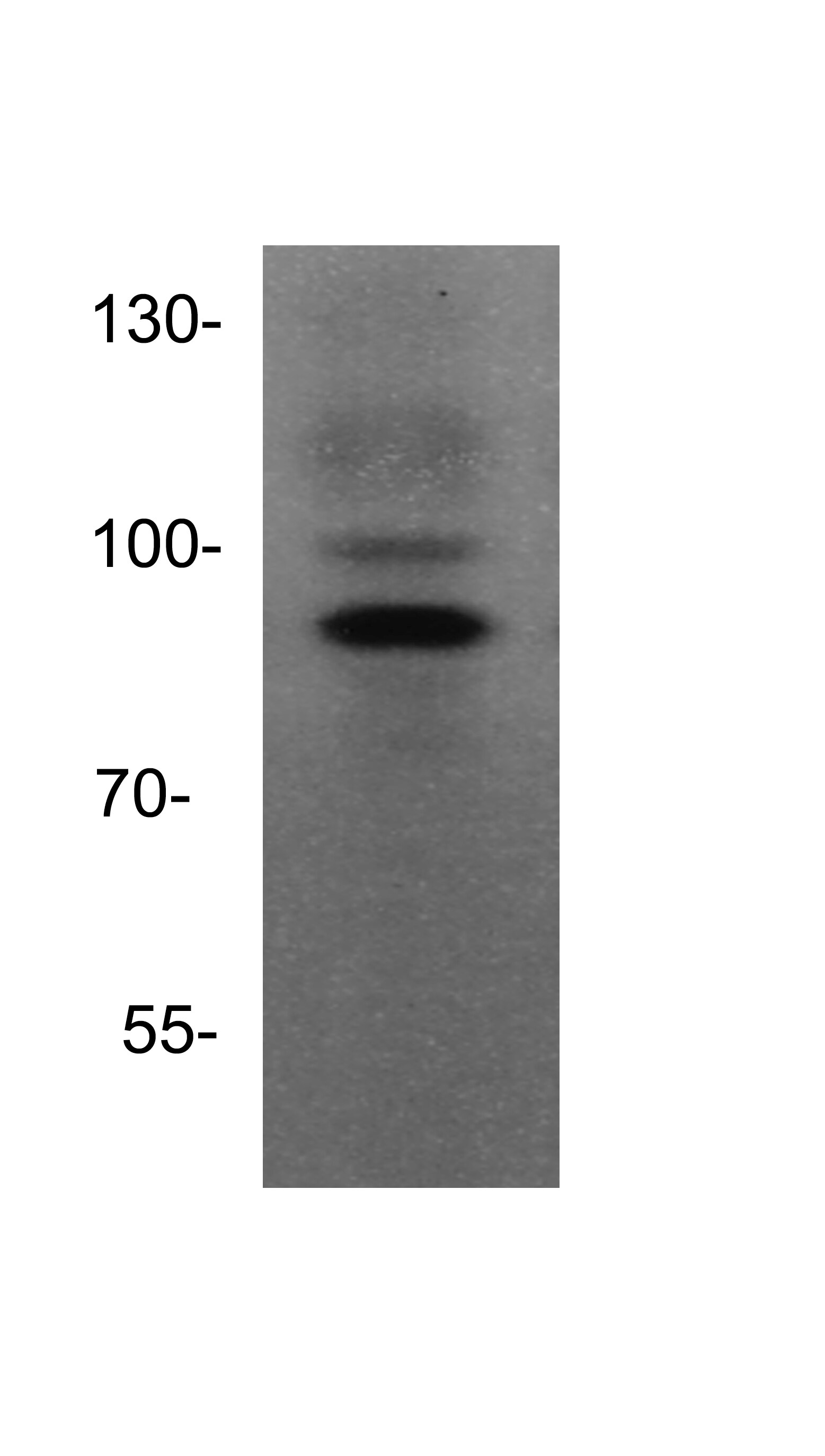 ADAM15 Antibody - BSA Free NBP1-59198