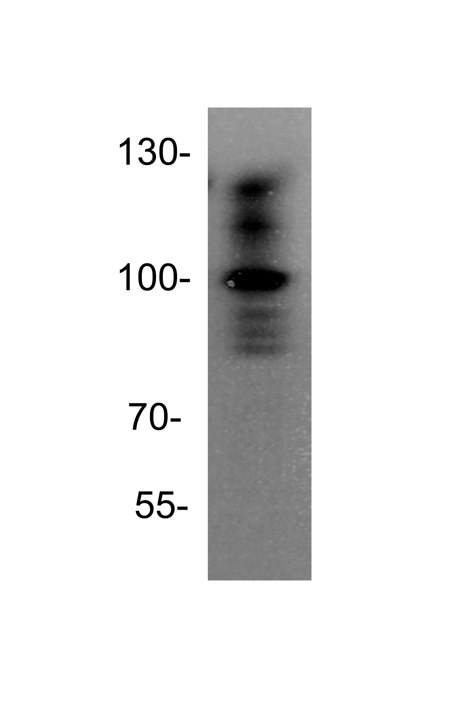 TACE/ADAM17 Antibody - BSA Free NBP1-77044