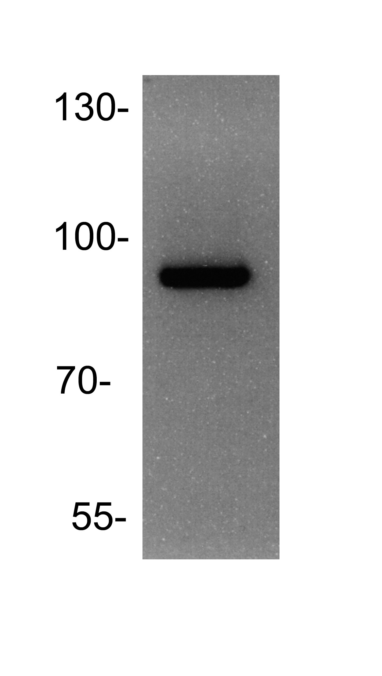 ADAM9 Antibody - BSA Free NBP1-59010