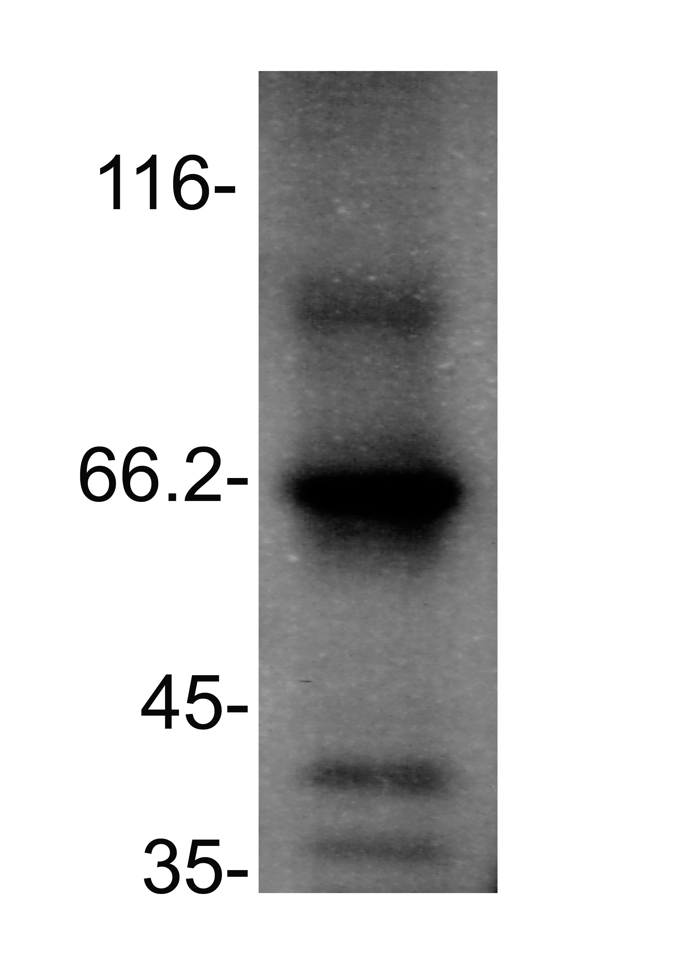 AKT3 Antibody (OTI9B2) NBP1-47657