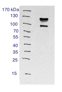 alpha-Actinin 1 Antibody - BSA Free NBP1-85791