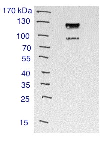 alpha-Actinin 1 Antibody - BSA Free NBP1-85791