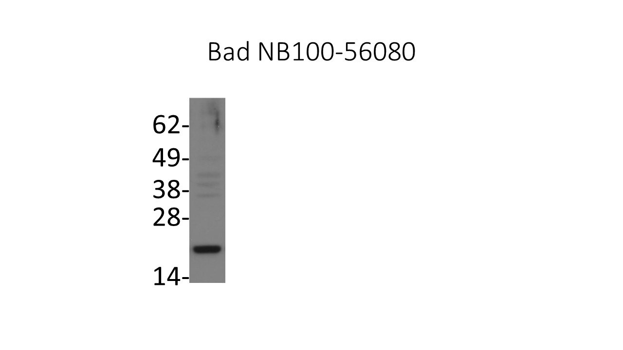 Bad Antibody - BSA Free NB100-56080