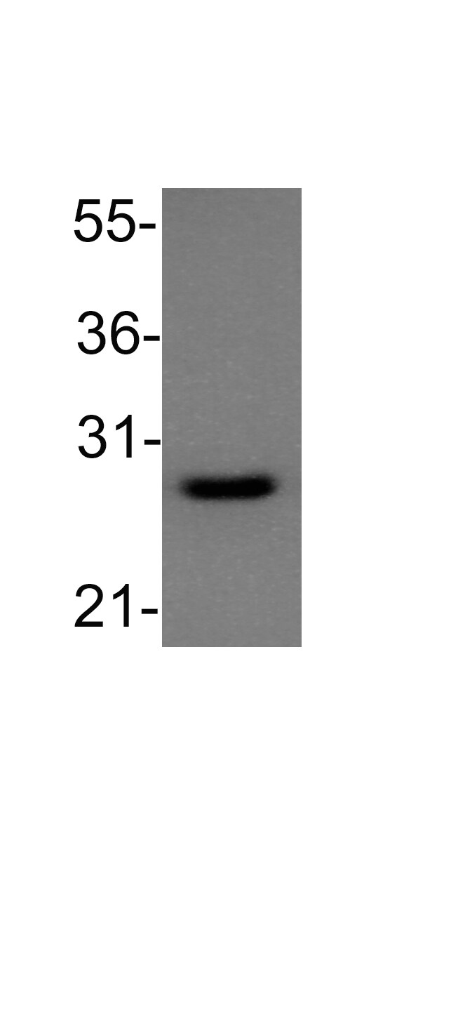Bcl-2 Antibody - BSA Free NB100-56098