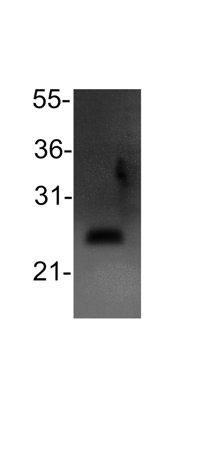 Bcl-2 Antibody - BSA Free NB100-56101