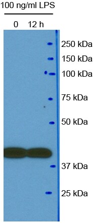beta-Actin Antibody (AC-15) NB600-501