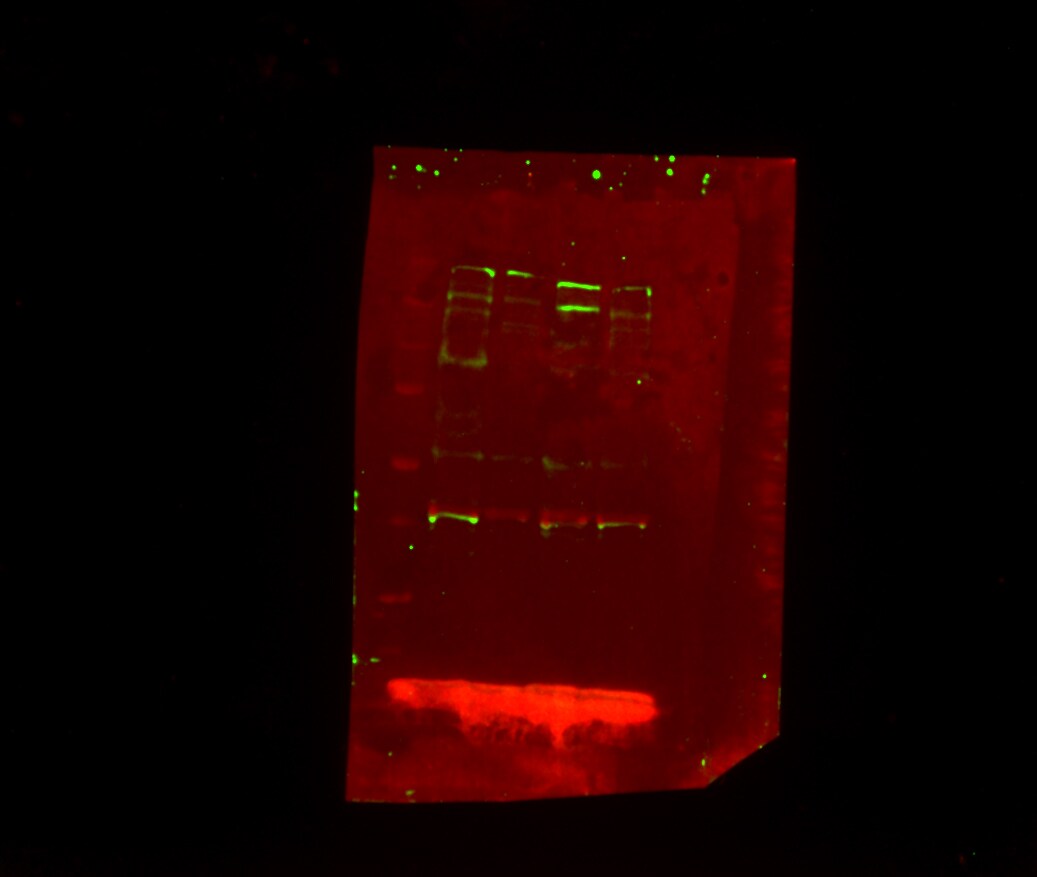 Blooms Syndrome Protein Blm Antibody - BSA Free NBP1-89929