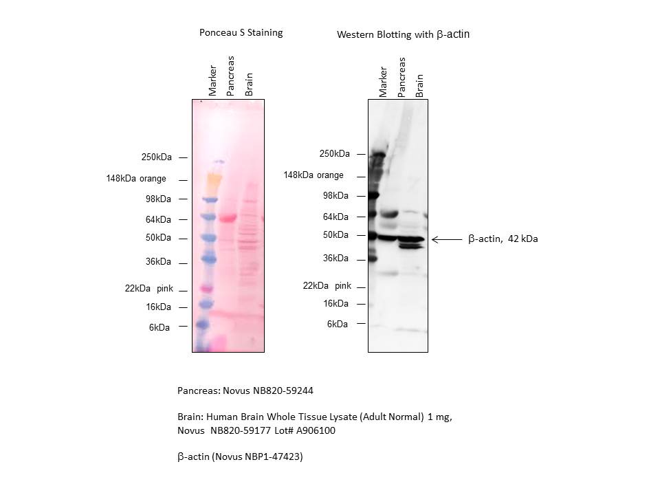 Human Brain Whole Tissue Lysate (Adult Whole Normal) NB820-59177