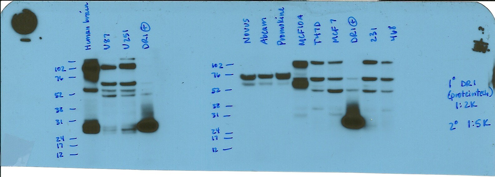 Human Breast Whole Tissue Lysate (Adult Whole Normal) NB820-59203