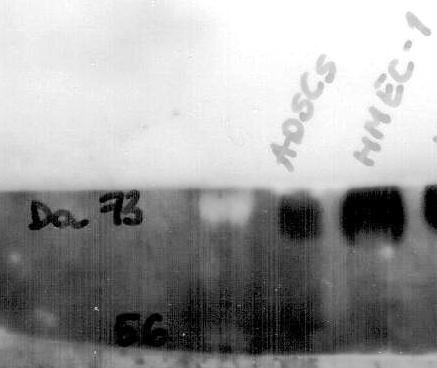 5'-Nucleotidase/CD73 Antibody - BSA Free NBP1-85740