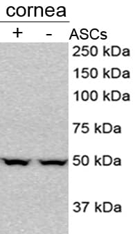 Mouse ST2/IL-33R Antibody AF1004