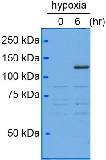 HIF-1 alpha Antibody (H1alpha67) NB100-105
