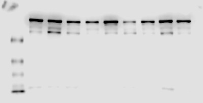 TOP2B Antibody NB100-40842