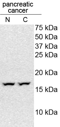 Histone H3 [Citrulline Arg17, Citrulline Arg2, Citrulline Arg8] Antibody NB100-57135