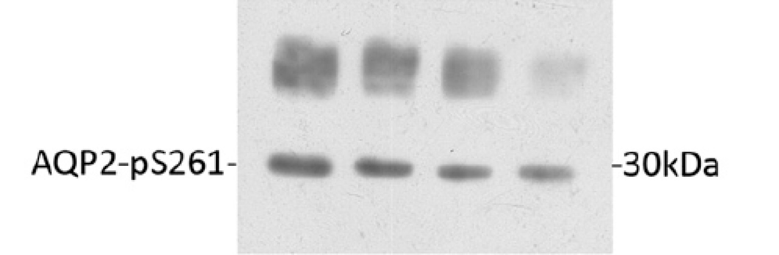 Aquaporin-2 [p Ser261] Antibody - Azide Free NB100-61100