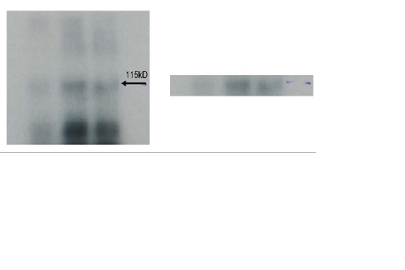 DNMT3A Antibody (64B1446) - BSA Free NB120-13888