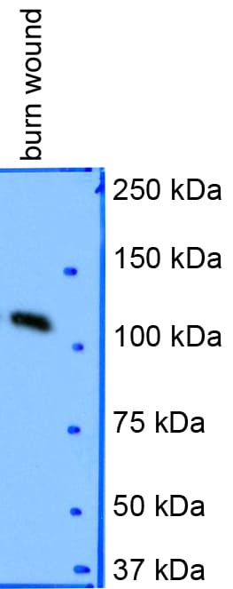 Collagen I Antibody - BSA Free NB600-408