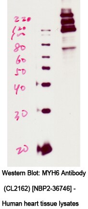 MYH6 Antibody (CL2162) - BSA Free NBP2-36746