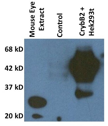 CRYBB2 Antibody (1F1) - Azide and BSA Free H00001415-M02