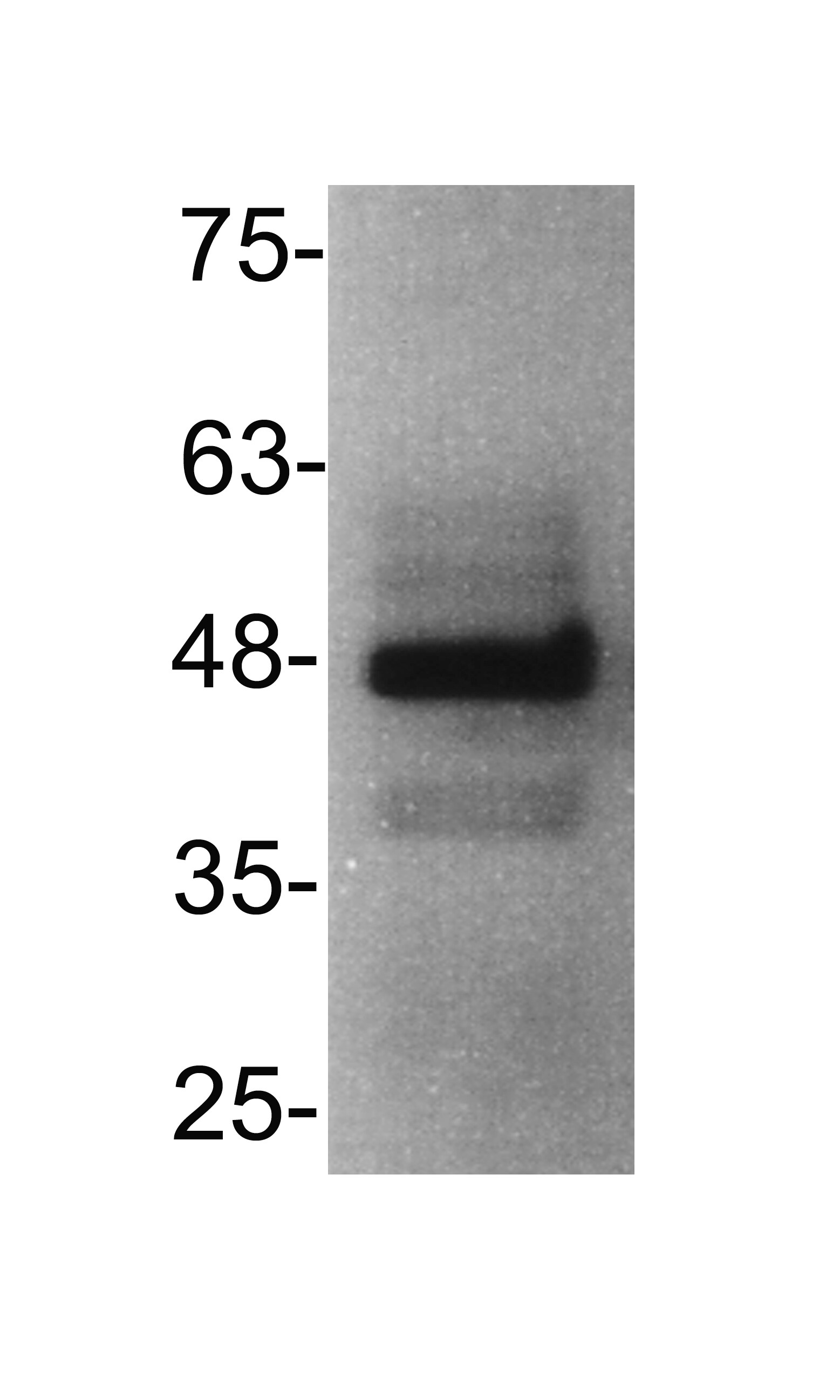 CXCR3 Antibody - BSA Free NB100-56404