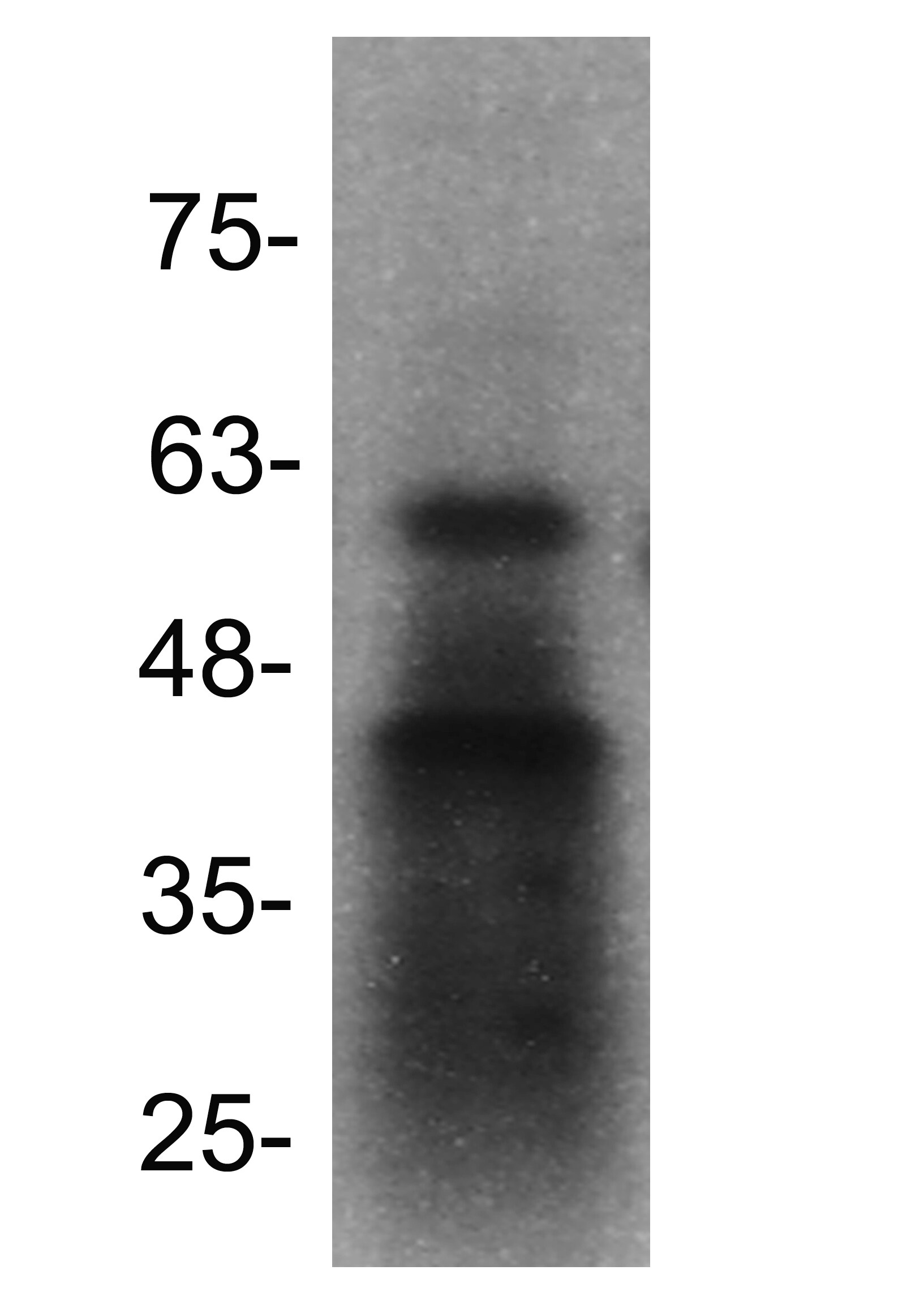 CXCR4 Antibody - BSA Free NB100-74396