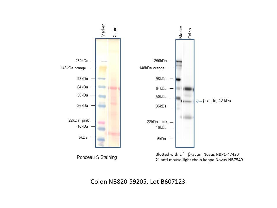 Human Colon Whole Tissue Lysate (Adult Whole Normal) NB820-59205