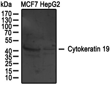 Cytokeratin 19 Antibody - BSA Free NBP1-78278