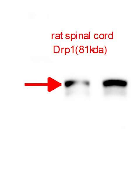 DRP1 Antibody - BSA Free NB110-55288