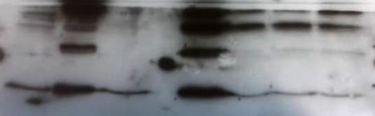 Dectin-1/CLEC7A Antibody NBP1-45514