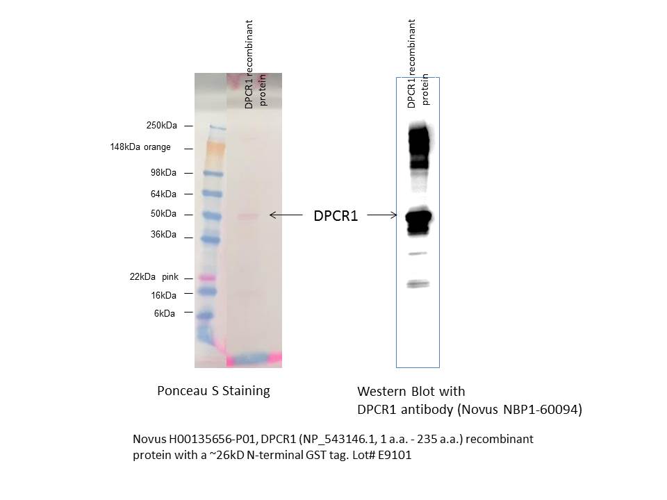 Recombinant Human DPCR-1 GST (N-Term) Protein H00135656-P01
