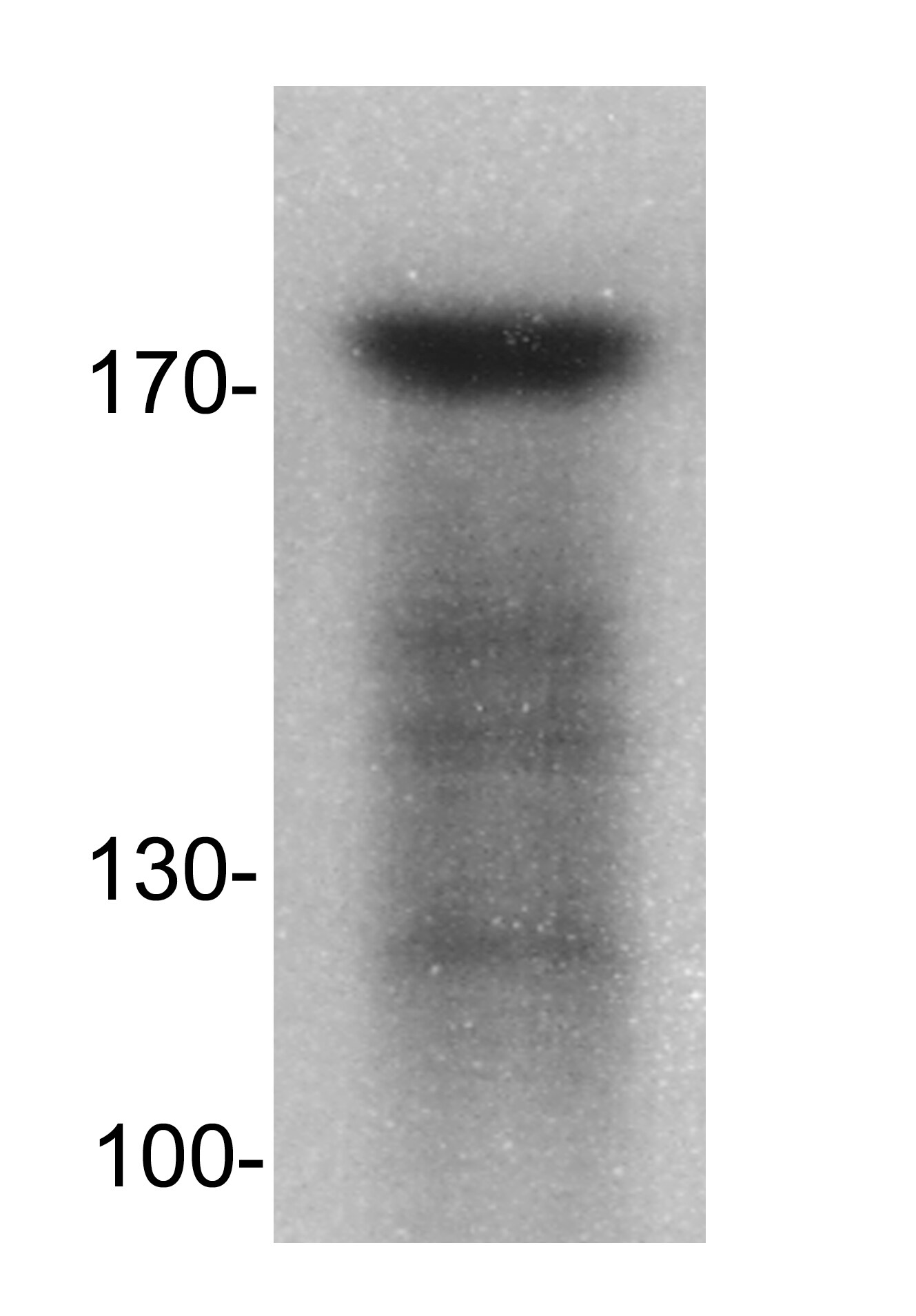 DNMT1 Antibody - BSA Free NB100-392