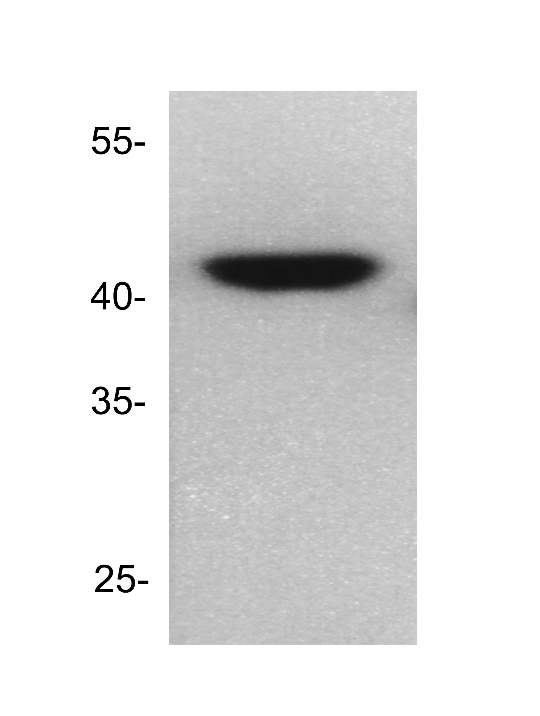 Dnmt2 Antibody NB200-616