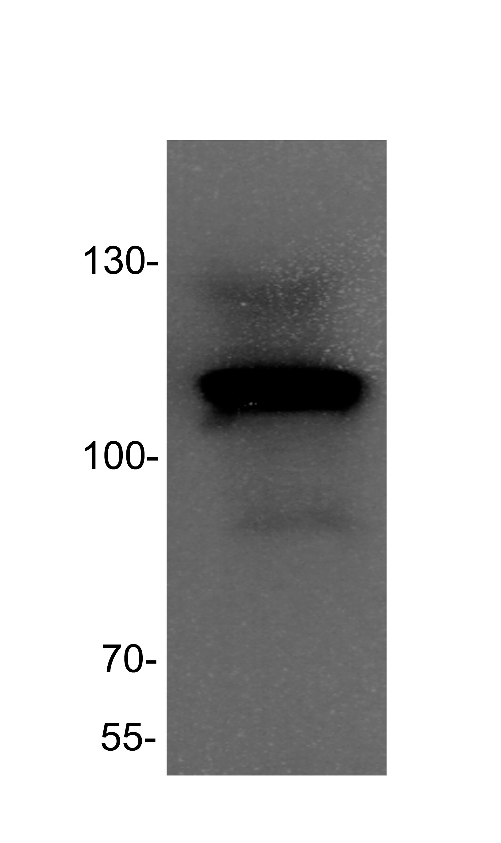 DNMT3A Antibody (64B814.1) - BSA Free NB100-56521