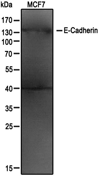 E-Cadherin Antibody (7H12) NBP2-19051