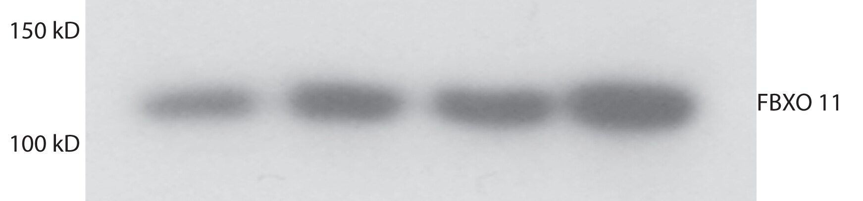 FBXO11 Antibody NB100-59825