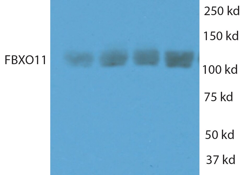 FBXO11 Antibody NB100-59826