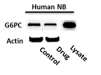 G6PC Overexpression Lysate NBP2-09053